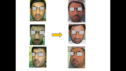 طارق صديقي | وظيفة الأنف عمان | تجميل الأنف | تجميل الأنف عمان | دكتور انف واذن وحنجرة عمان | - مسقط - +968 9576 2227