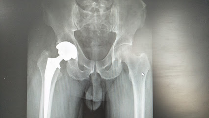 جراح استبدال مفصل الورك والركبة - الدكتور بيسواجيت باروح - مسقط - +968 7154 5984